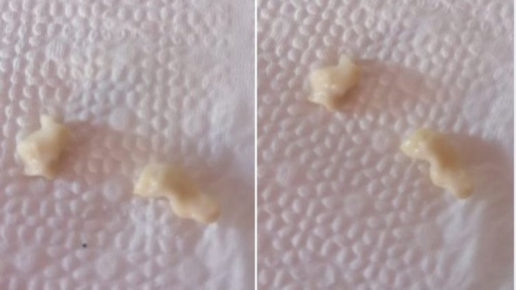 Зъбки в брашното! Певицата Катя Близнакова потресена от находката