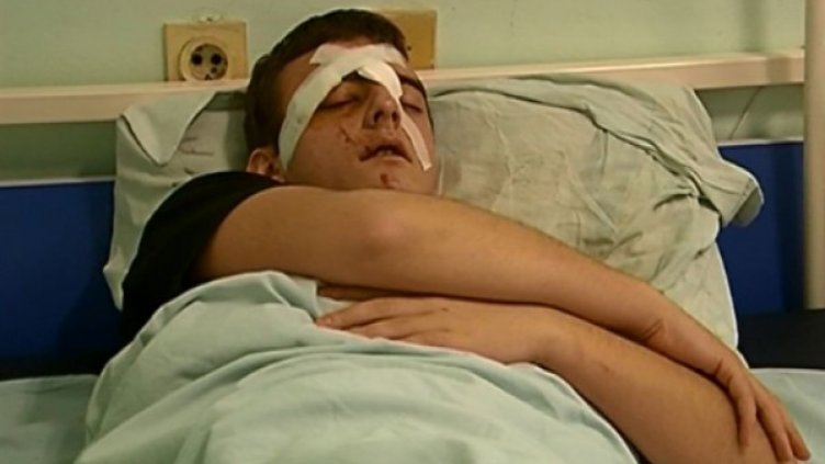 Пребитият тийнейджър е в болница Снимка: Dnes.bg