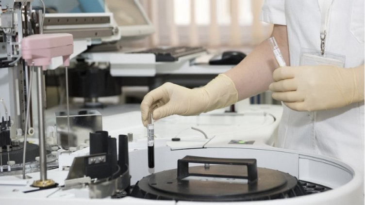 Здравната каса иска НЗОК да плаща за повече изследвания