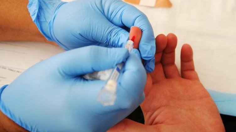 Изследват безплатно за хепатит B и C във Варна днес