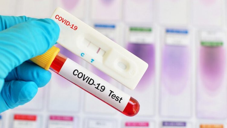 1047 са новите случаи на COVID, близо 5% са положителните проби