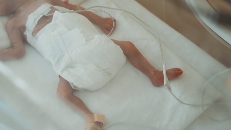 Правят мащабно дарение на специализирани пелени за недоносени бебета