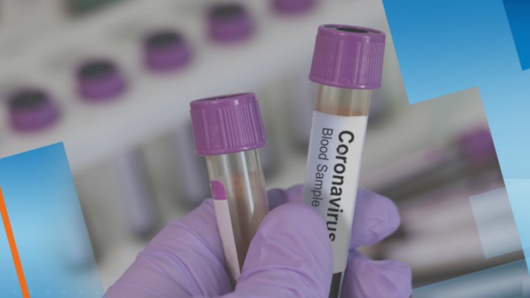 Председателят на ПГ на ГЕРБ Даниела Дариткова и депутатът Даниела Малешкова са с коронавирус