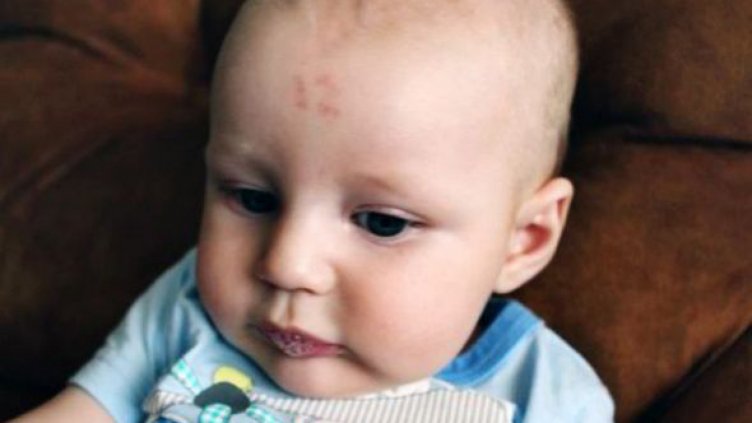 Бебе се роди с 12 на челото