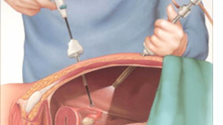 Демонстрират първия у нас симулатор за безкръвни операции