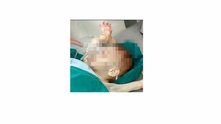 Пребити 3-годишни близнаци са в болница, майката е в ареста