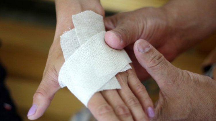 3-годишно дете с тежко изгаряне, родители обвиняват лекари 