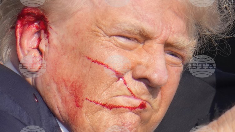 Доналд Тръмп е с двусантиметрова рана на ухото след стрелбата