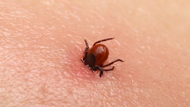 14 варненци пропищяха от кърлежи за седмица