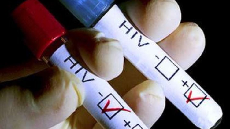 Лекарите се страхували от ХИВ-позитивните, не ги искат за пациенти