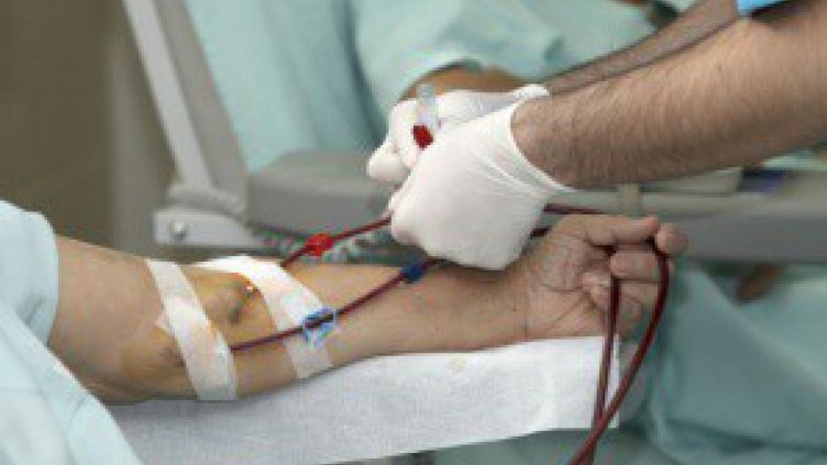 Създадоха първия изкуствен бъбрек за имплантиране