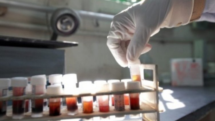 Руски учени създадоха лекарство против инсулта