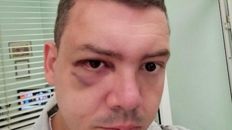 Пребиха председателя на КТ "Подкрепа"