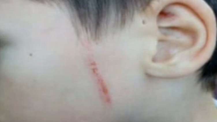 Уволниха учителка заради насилие над дете