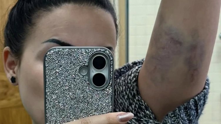 Произвол: Жена се жалва, че е бита от полицаи (СНИМКИ/ВИДЕО)