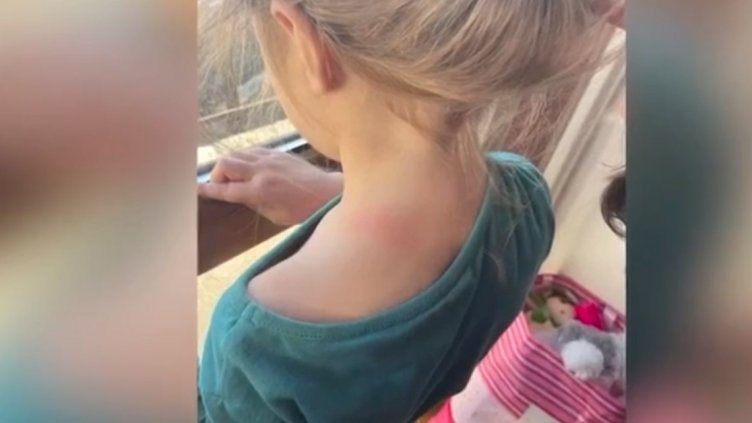 Малтретират ли деца в градините? Родители алармират за насилие (ВИДЕО)