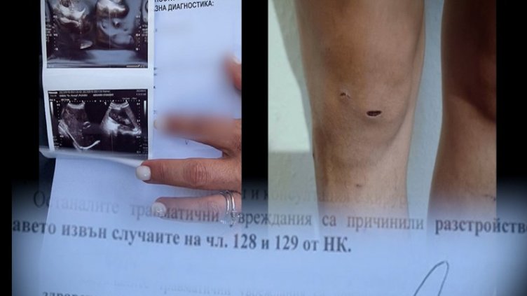 Жестокост: Млада майка е пребита от съпруга си (ВИДЕО)