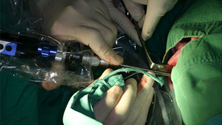 В АГ-то във Варна безкръвните операции станаха рутинна практика