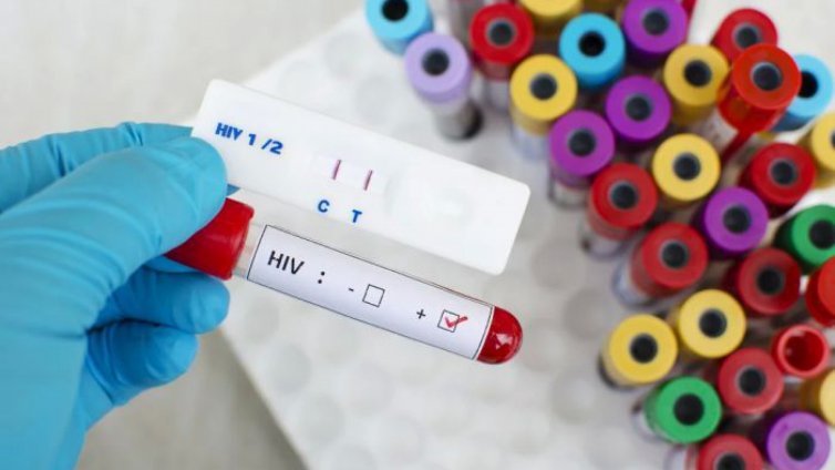 Увеличават се случаите на зараза с ХИВ в Източна Европа