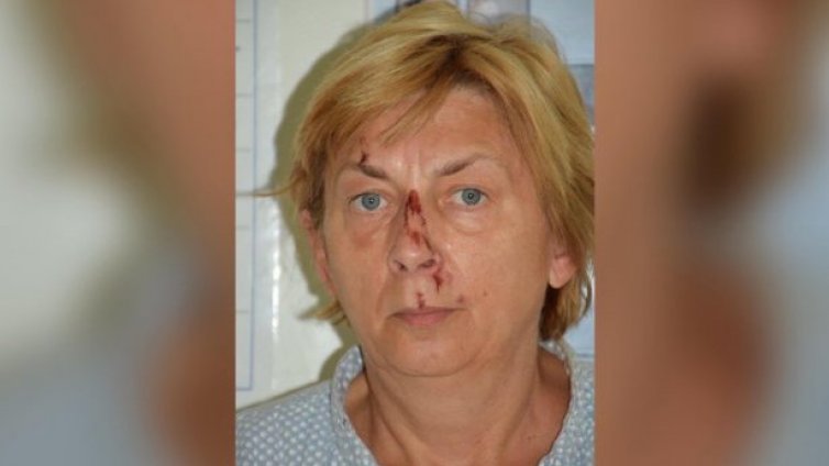 И тя е… Словачката Даниела открита с амнезия на хърватския остров Крък