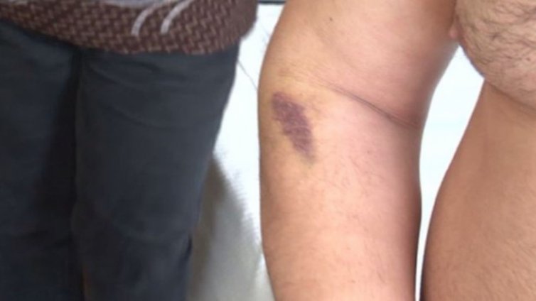 МВР проверява обвинения на майка и син за полицейски тормоз в Плевен