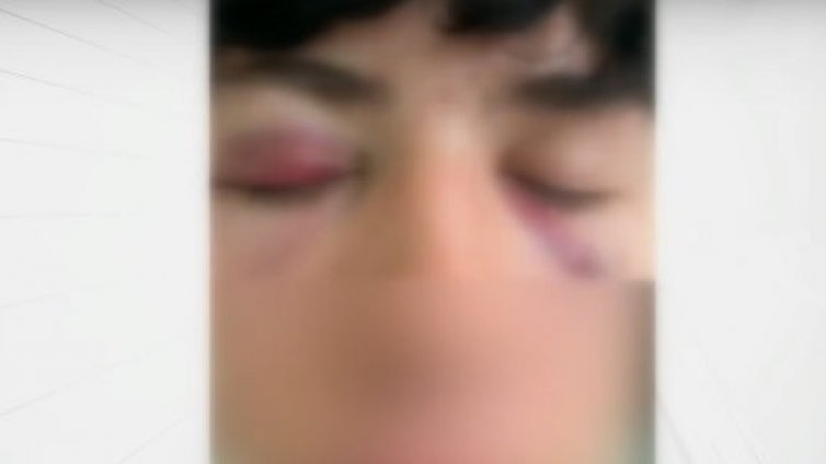 При спор за цигара: Дете е в болница след побой от младеж