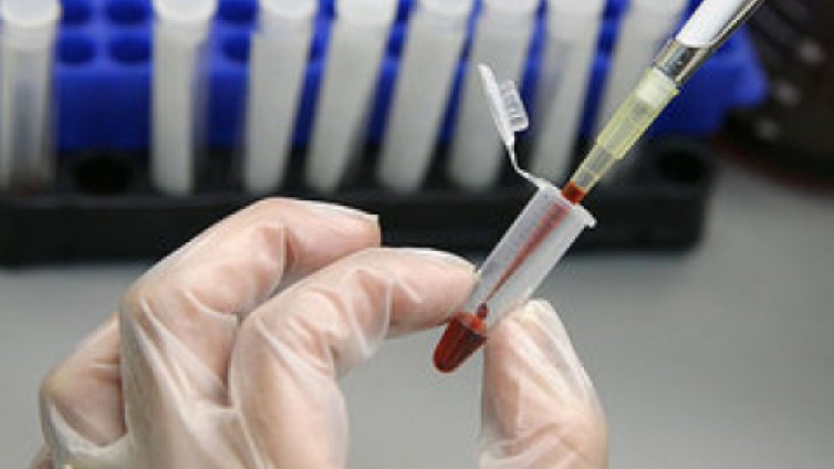 Случай на марсилска треска е регистриран във Варна