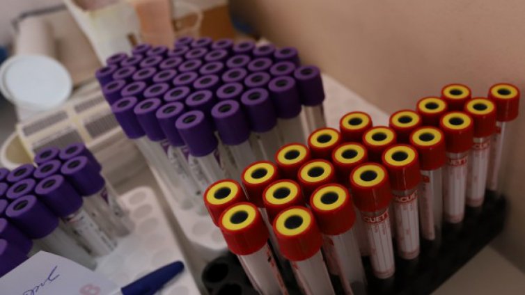 1704 станаха потвърдените случаи на COVID-19 у нас