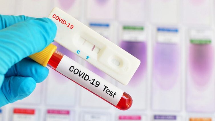Нов ръст на случаите на COVID у нас - 500 заразени и 14 починали за ден