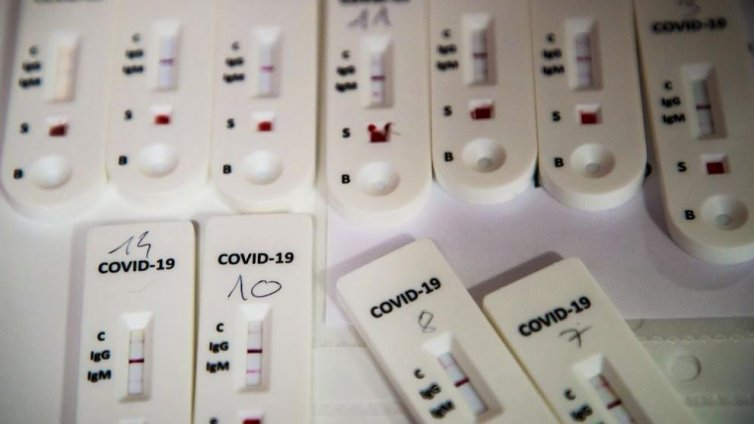 36 нови случаи на COVID у нас, 3 от тях са от Варна