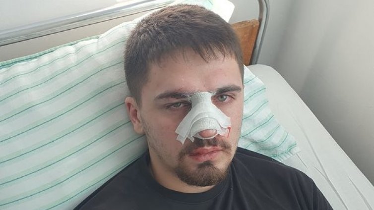 Баща проплака с пост: Четирима полицаи пребиха сина ми като куче!