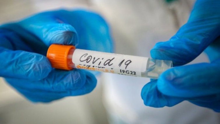 360 са новозаразените с COVID, 5 души са починали