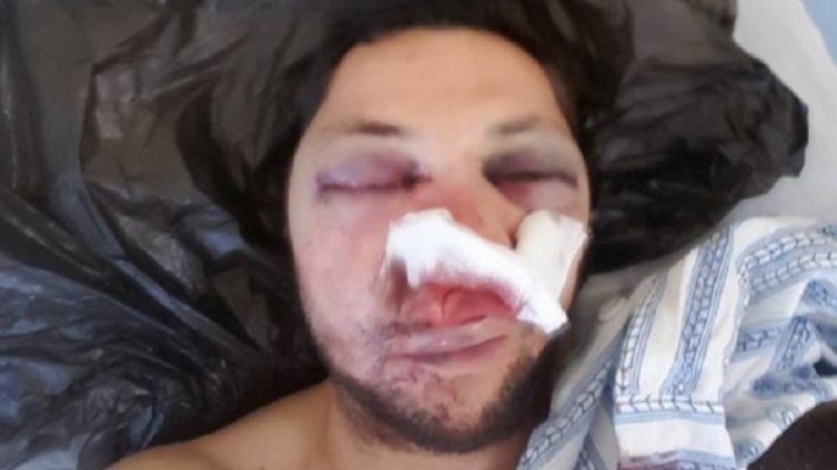 Война в Поморие: Кметът срещу пребития журналист