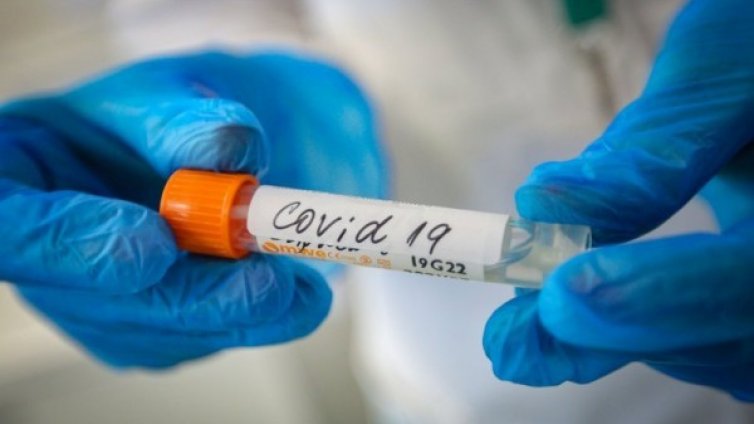 164 новите случаи на COVID и един починал за денонощие у нас