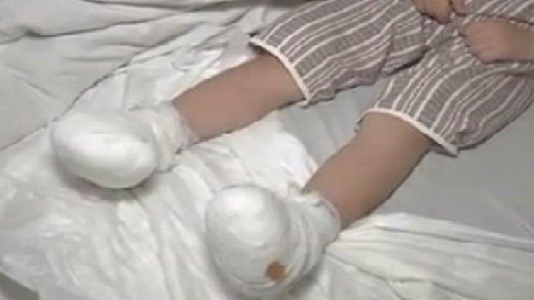 Детето с премръзналите крачета вече е транспортирано в "Пирогов"