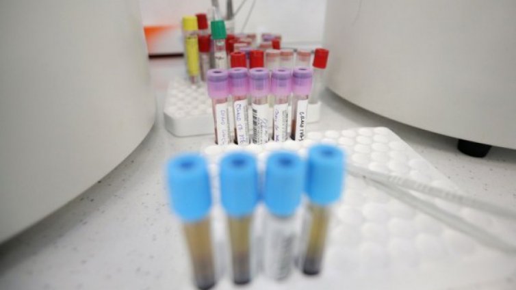 Четири държави с интерес към българско лекарство срещу коронавирус