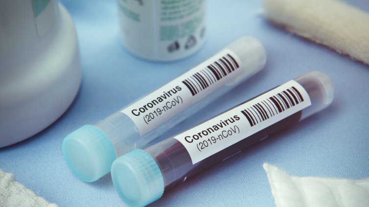 Варненец даде положителна проба за COVID-19